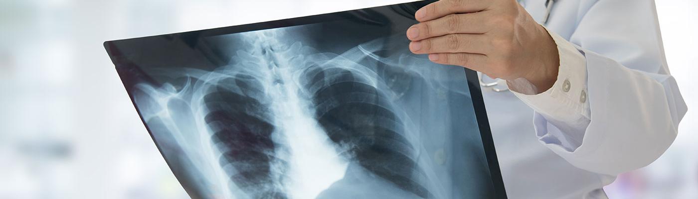 Radiología